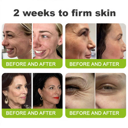 Elvarisi® Skin Tightening & Vita-A Retinol Retinol shot Anti-Wrinkle Firming Tightening cream