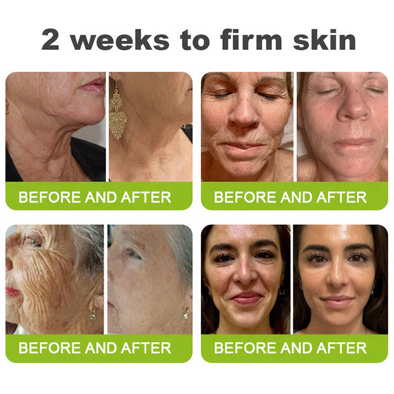 Elvarisi® Skin Tightening & Vita-A Retinol Retinol shot Anti-Wrinkle Firming Tightening cream